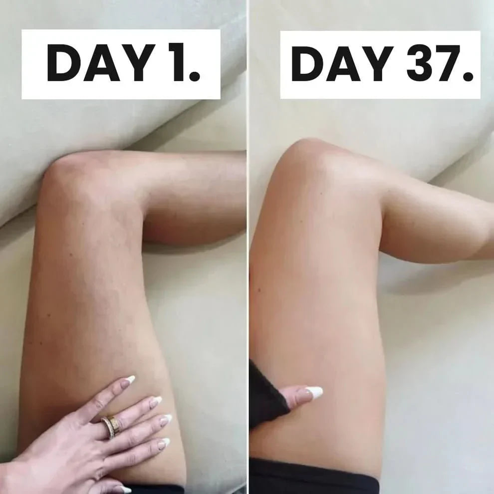Wellness™ Cellulite Relief Kit